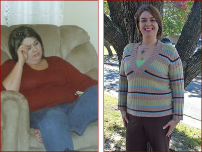 Bariatric surgery results Jeannie