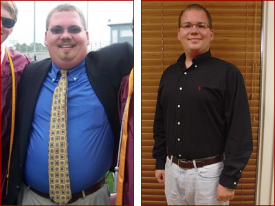 Bariatric surgery results Charlie