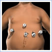 Gastric band instrument placement