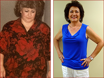 Bariatric Surgery Results Betty