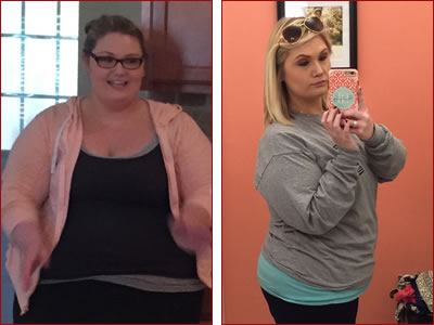 Brittany picture before and after weight loss surgery