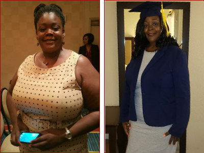 Alonza Lost 68 Pounds after weight loss surgery