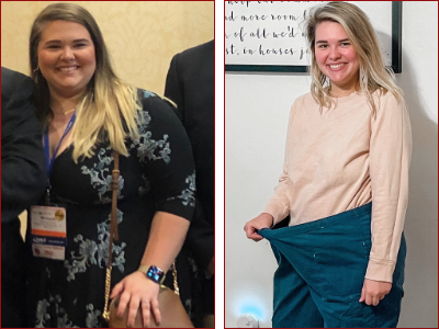Patient Results for Weight Loss Surgery